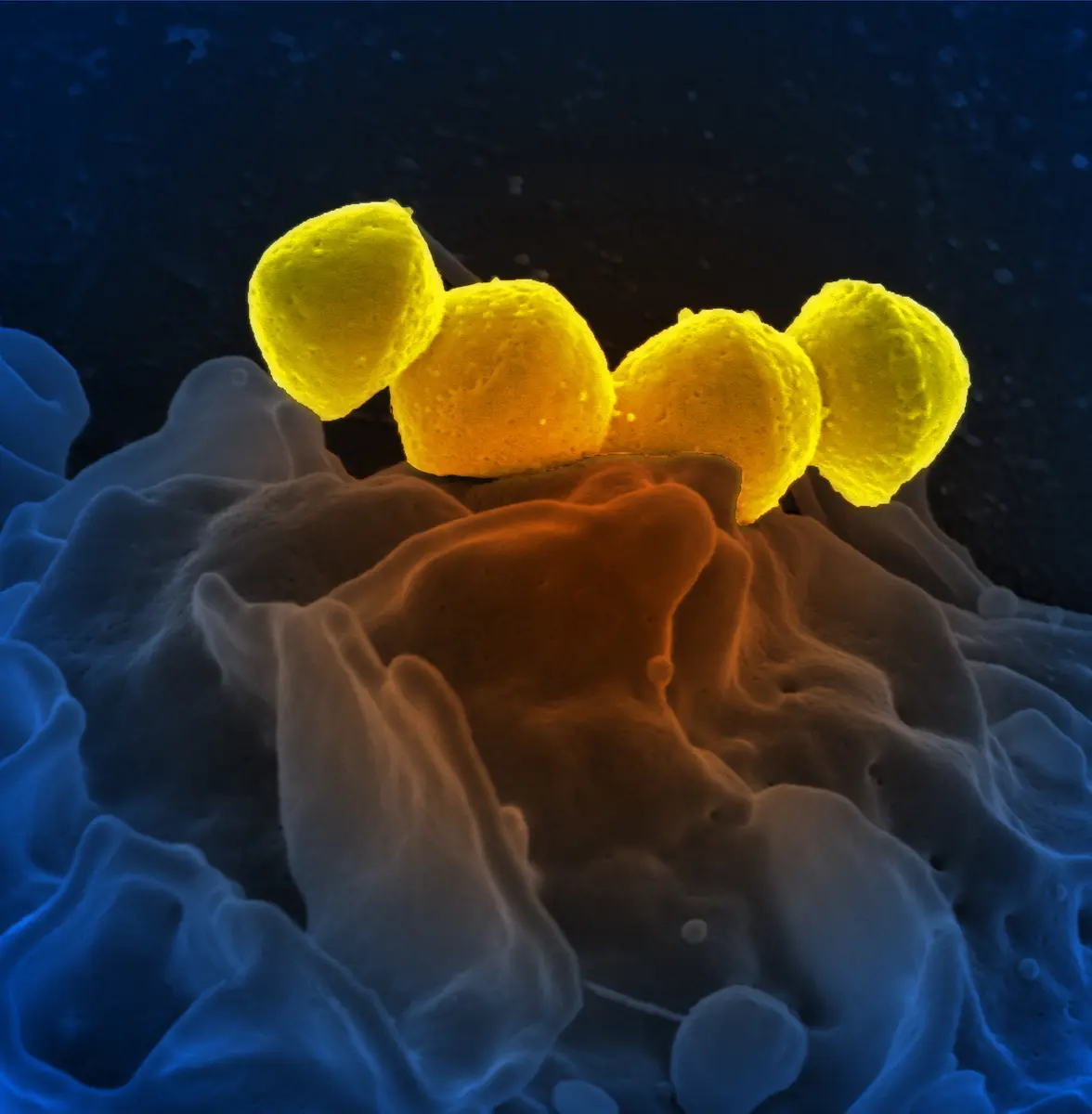 CRISPR gene editing