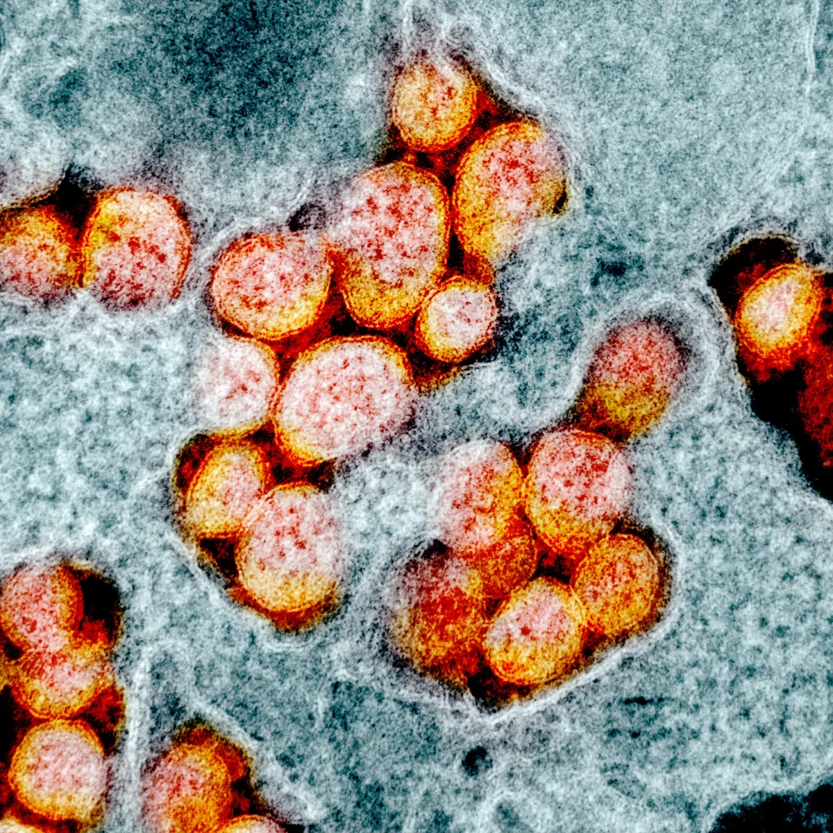 mRNA vaccines