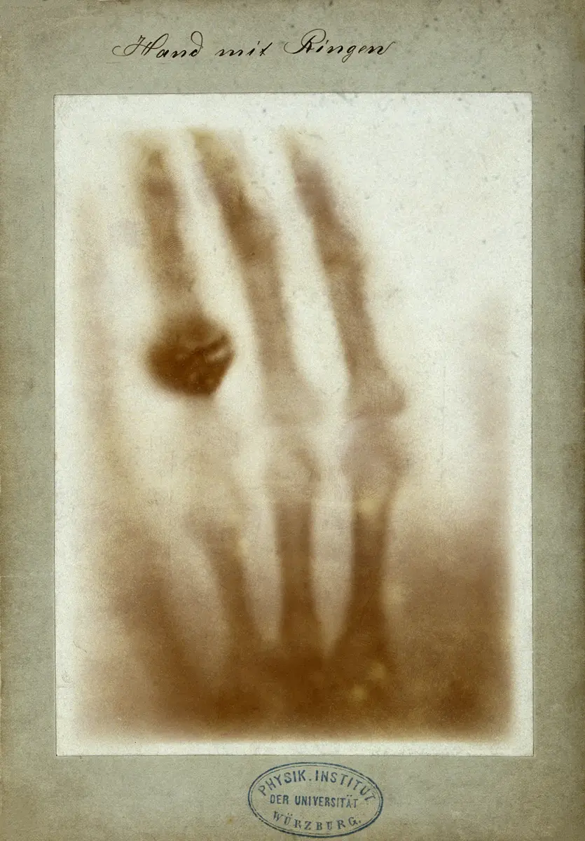 X-rays are discovered